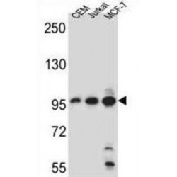 Aftiphilin (AFTPH) Antibody