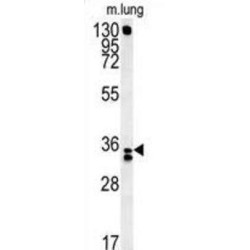 Reticulocalbin 3 (RCN3) Antibody