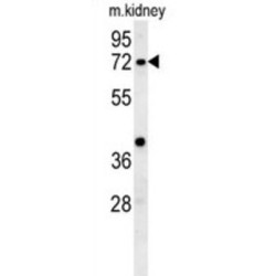 Kelch-Like Protein 6 (KLHL6) Antibody