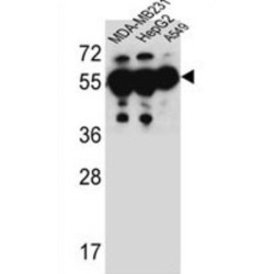 Ankyrin Repeat Domain 57 (ANKRD57) Antibody