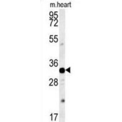 Aquaporin-11 (AQP11) Antibody
