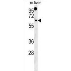 Rhotekin 2 (RTKN2) Antibody