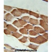 abx032627
