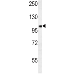 Sodium/Potassium-Transporting ATPase Subunit Alpha 2 (ATP1A2) Antibody