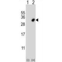 Glutathione S Transferase Omega 2 (GSTO2) Antibody
