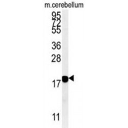 Beta-Synuclein (SNCB) Antibody
