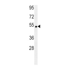 Transcription Factor SOX-10 (SOX10) Antibody