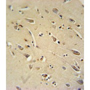 abx032641