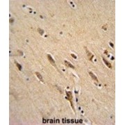 ADP-Ribosylation Factor 1 (ARF1) Antibody