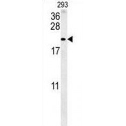 Protachykinin-1 (TAC1) Antibody