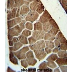 Adenylosuccinate Synthetase Isozyme 1 (ADSSL1) Antibody