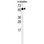 WB analysis of mouse bladder tissue lysates (15 µg/lane).