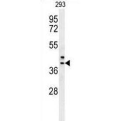 Calcium Modulating Ligand (CAMLG) Antibody