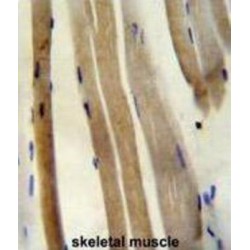 Citrate Synthase (CS) Antibody