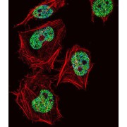 Cut Like Homeobox 1 (CUX1) Antibody