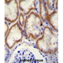 Cut Like Homeobox 1 (CUX1) Antibody