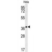 Interleukin 24 (IL24) Antibody
