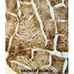 Sphingomyelin Phosphodiesterase 4 (SMPD4) Antibody
