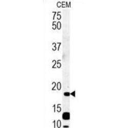 c-Myc-Responsive Protein RCL (DNPH1) Antibody