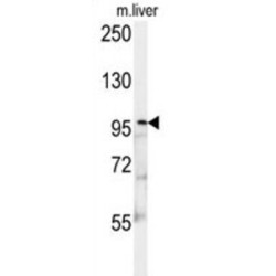 Kinesin-Like Protein KIF9 (KIF9) Antibody