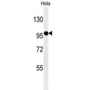 KIAA1688 Antibody