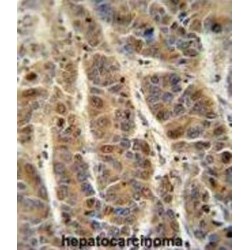 C4b-Binding Protein Alpha Chain (C4BPA) Antibody