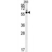 5-Hydroxytryptamine Receptor 3C (HTR3C) Antibody