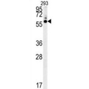 5-Hydroxytryptamine Receptor 3C (HTR3C) Antibody