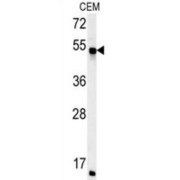 Peptidyl-Prolyl Cis-Trans Isomerase FKBP8 (FKBP8) Antibody