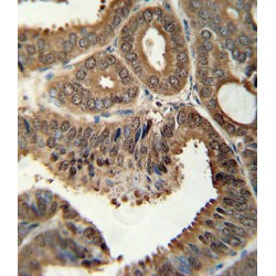 14-3-3 Protein Sigma (SFN) Antibody