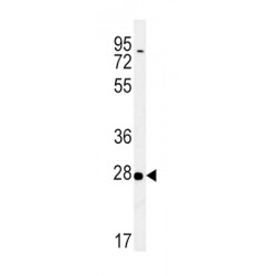 14-3-3 Protein Sigma (SFN) Antibody