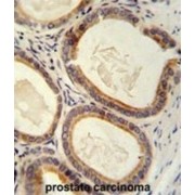 Translocating Chain-Associated Membrane Protein 2 (TRAM2) Antibody