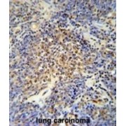 OTU Deubiquitinase 4 (OTUD4) Antibody