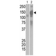 SARS virus Sm Antibody