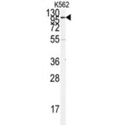 Angiotensin-Converting Enzyme 2 (ACE2) Antibody