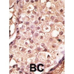 Angiotensin Converting Enzyme 2 (ACE2) Antibody