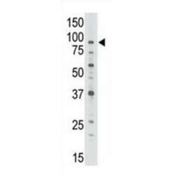 ATP Binding Cassette Subfamily B Member 7 (ABCB7) Antibody