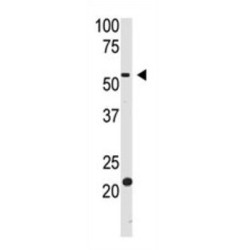 Beta-Site APP Cleaving Enzyme 2 (bACE2) Antibody