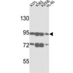 ATP-Binding Cassette Subfamily B Member 5 (ABCB5) Antibody