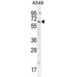 Baculoviral IAP Repeat-Containing Protein 3 (BIRC3) Antibody