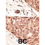 Homeobox Protein CDX-2 (CDX2) Antibody