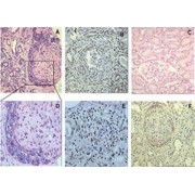 Gremlin 1 (GREM1) Antibody