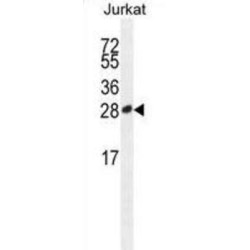 Inducible T-Cell Costimulator (ICOS) Antibody