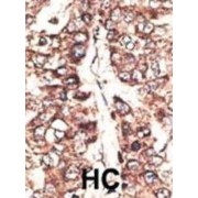 Melanoma-Associated Antigen 11 (MAGEA11) Antibody