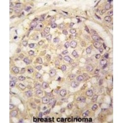 Melanoma-Associated Antigen 4 (MAGEA4) Antibody