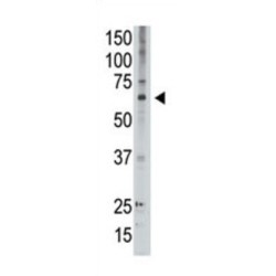 Melanoma-Associated Antigen D2 (MAGED2) Antibody