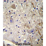 MAGE Family Member L2 (MAGEL2) Antibody
