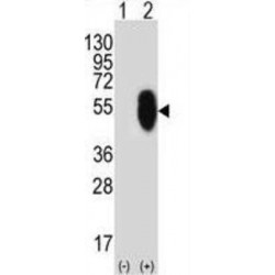 Protein AF-17 (MLLT6) Antibody