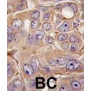 Matrix Metalloproteinase 12 (MMP12) Antibody