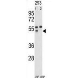 Matrix Metalloproteinase 12 (MMP12) Antibody